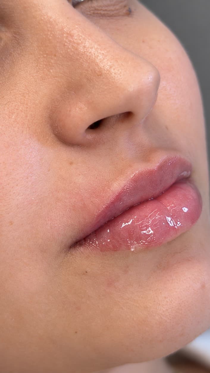 Lábios hidratados, macios e com aquele efeito gloss natural.
O Hidra Gloss é um cuidado d